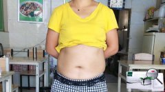 <b>朋友刘志在服用赛乐赛减肥药一年半后成功减掉70斤</b>